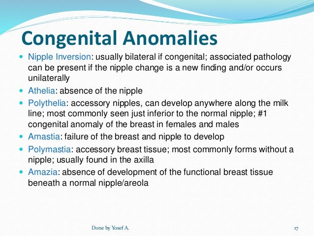 congenital anomalies of the breast Crystal gunns nude photographs